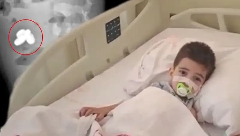 Pil ve Mıknatıs Yutan Çocukta Yaşanan Şok Edici Olay