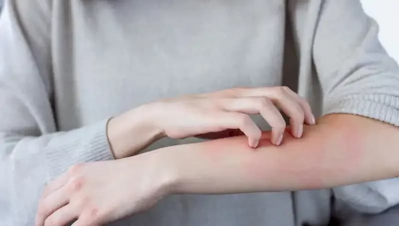 Cilt Kanserinin Gizli Belirtileri: Dermatologdan Önemli Uyarılar