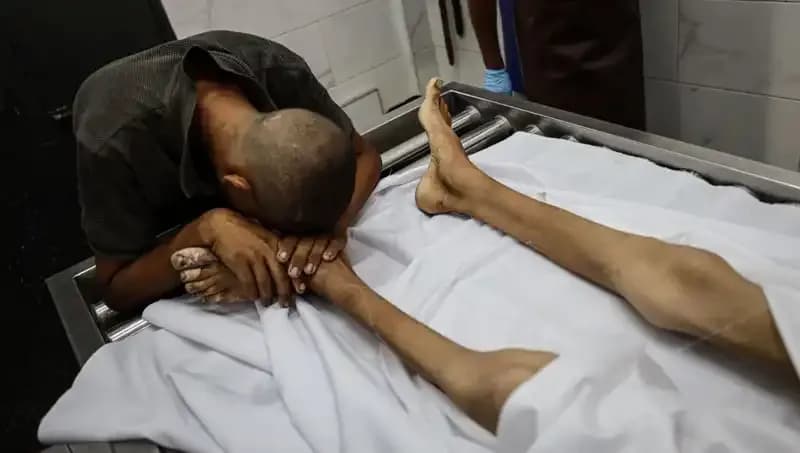 Gazze'deki Çocukların Acı Gerçekliği: Açlık ve Yoksulluk Can Almaya Devam Ediyor