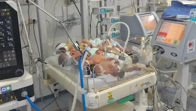 Gazzeli Doktorların Çaresizliği: Aynı Kuvözde Birden Fazla Bebek