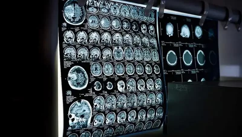 İstanbul'da 81 Bin Kişiye Ücretsiz Kanser Taraması Hizmeti