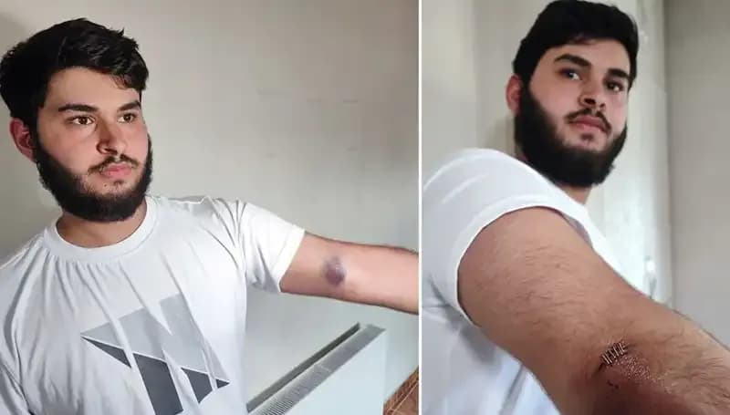 Mahallede Abartılı Top Olayı: "Conolar Kamyonetle Geldi" İfadesi Ne Anlama Geliyor?